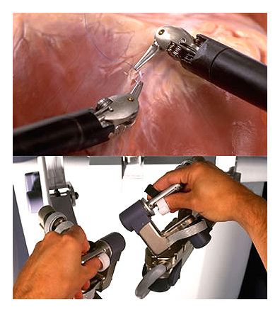 motion control - maxon motors in surgery